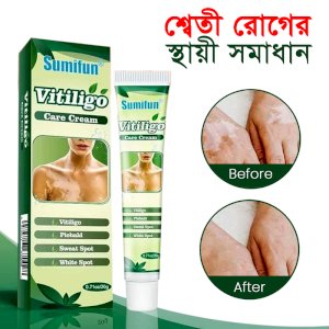Vitiligo Treatment Herbal Cream 2 pcs